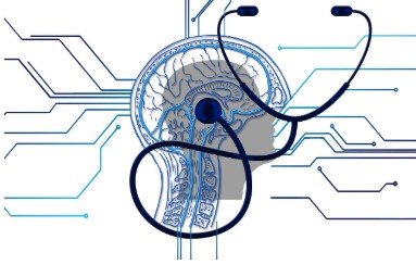 Treating brain fog is important to enrich your brain's overall health