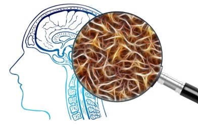 Identifying the exact cause of brain fog is important